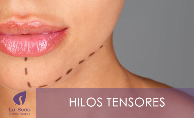 Hilos Tensores - La Seda Centro Médico